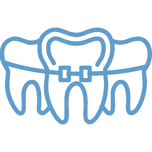 Ortodonzia Fissa e con Allineatori