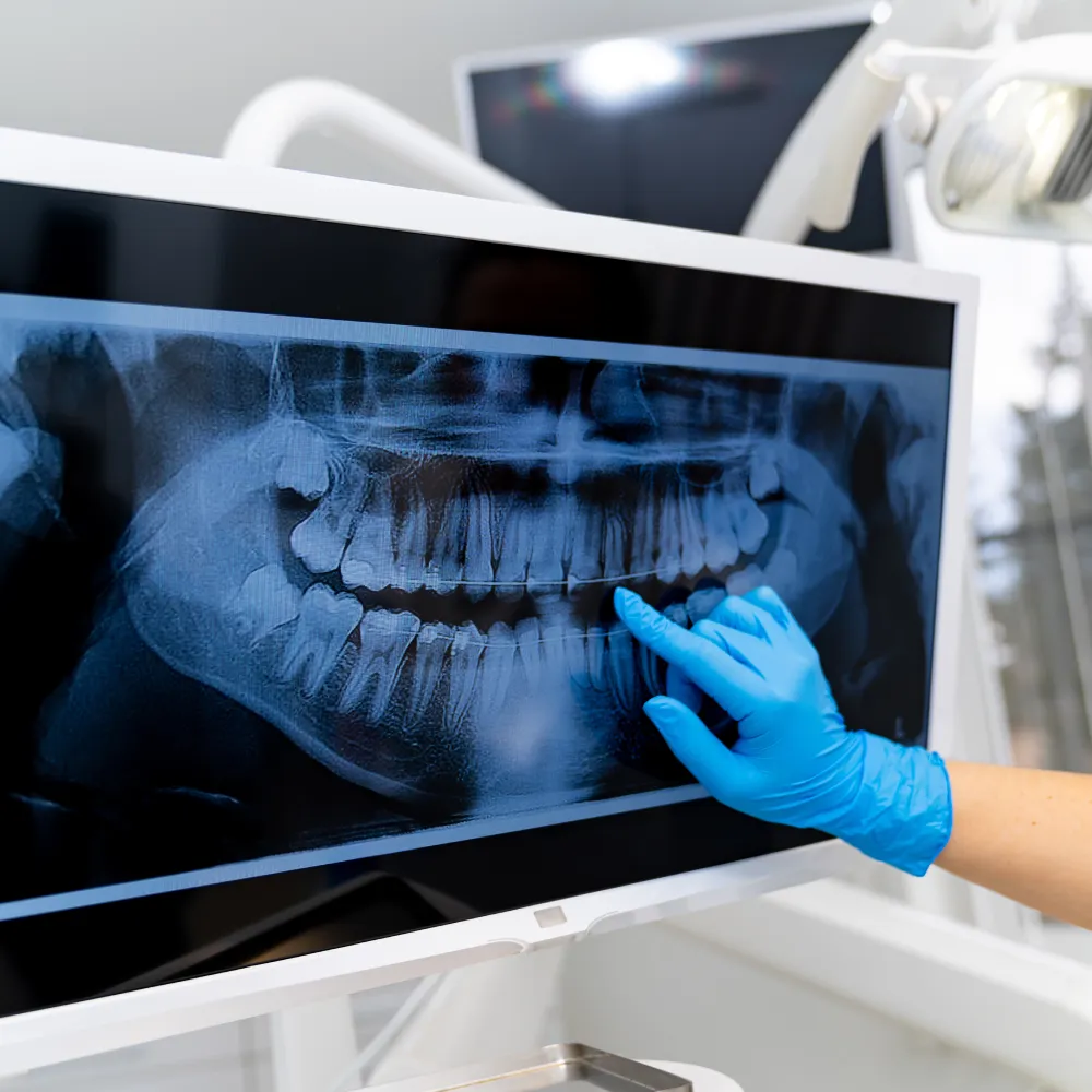 La Fata Dei Denti Radiografie e Panoramiche