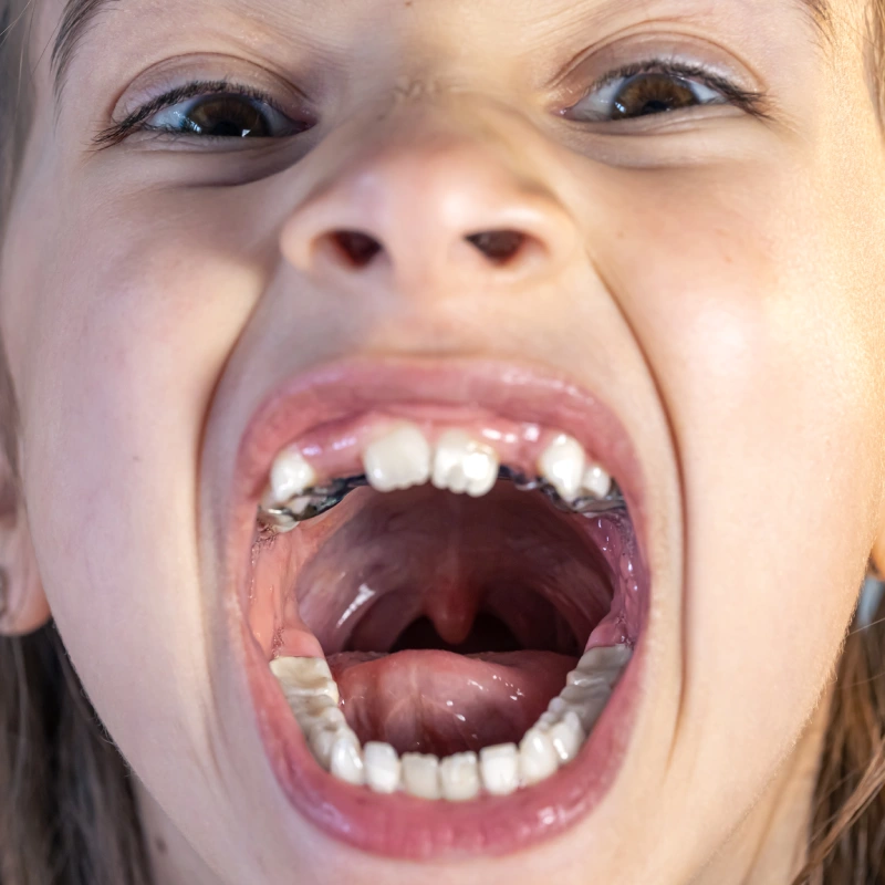 La Fata Dei Denti Ortodonzia Intercettiva Ortopedica e Funzionale